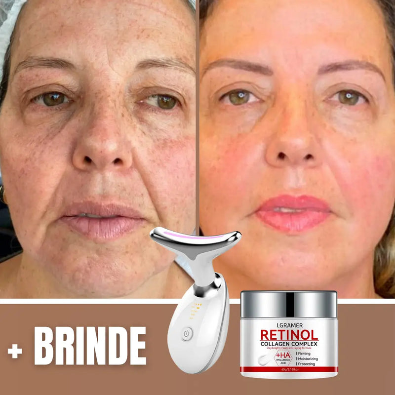 Massageador Rejuvenescedor Anti Rugas l Revita Face + BRINDE