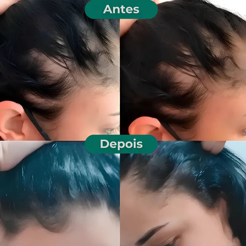Growth Hair efeito antiqueda e fortalecedor de fios