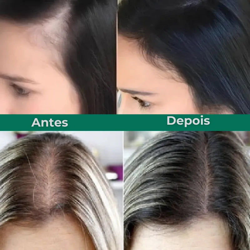 Spray Growth Hair aplicado na raiz para acelerar crescimento