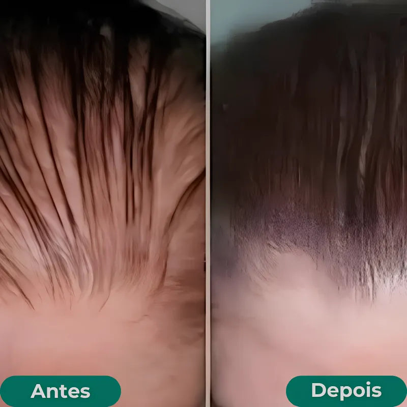 Growth Hair para cabelos finos com efeito volumizador