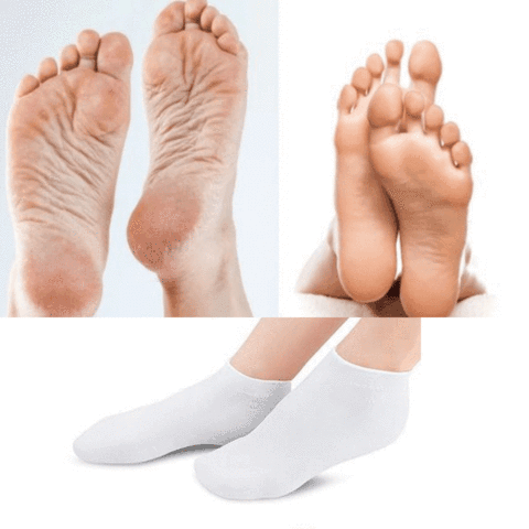 Meia Feminina para Hidratar os Pés e Calcanhar - COMPRE 1 LEVE 2