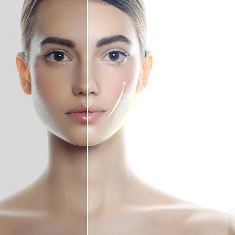 Levantamento Facial Led Fóton.